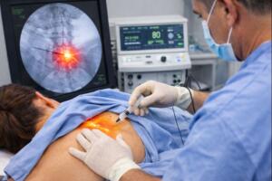 Procedimiento médico de ablación por radiofrecuencia